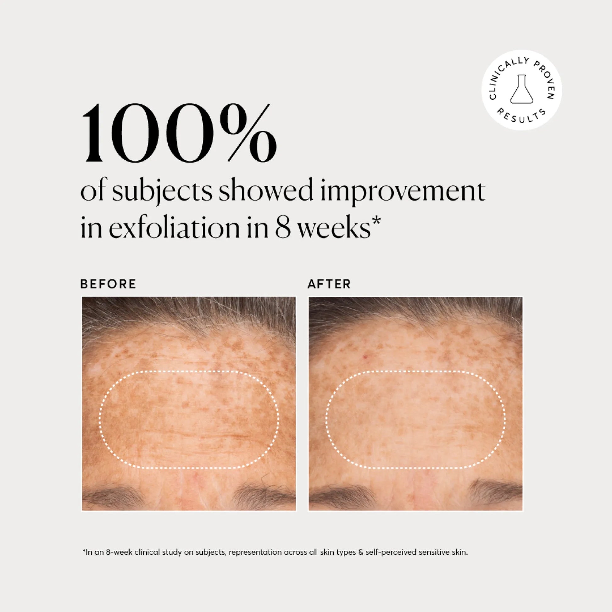 bha-liquid-exfoliant-2-t4 NATR-10027-Alt-Images-BHA-Liquid-Exfoliant-2_-03.webp